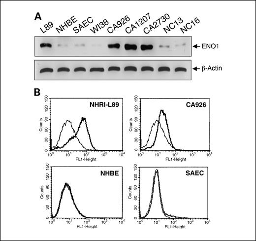 Fig. 3. Overexpression and surface staining of ENO1 in effusion tumor cells. A, tumor or mesothelial cells were obtained from pleural effusions of 17 patients with lung cancer or 6 patients with non-cancer-associated diseases, respectively. Among them, tumor cells from four cancer patients, including L89 cells, and effusion cells from two control patients are representative cases. Normal human bronchial epithelial (NHBE) and small airway epithelial (SAEC) cells are normal human lung primary cells. WI38 is lung embryonic fibroblast cell line. Cell lysates (30 μg) were resolved on 10% SDS-PAGE and immunoblotted with ENO1 antiserum. After stripping, the same blot was reprobed with β-actin antibody as a loading control. B, intact whole cells were stained with (dark line) or without (gray line) ENO1 antiserum. L89, CA926, and two lung primary control cells are representative cases.