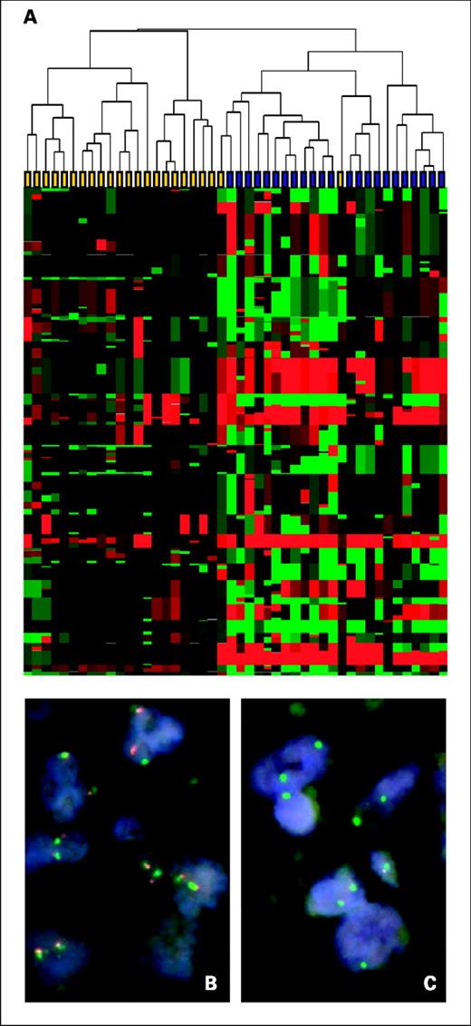 Fig. 3. A, unsupervised hierarchical clustering of all MSI-H and MSS tumors. Dendrogram shows two main clusters largely separating MSI-H (yellow) and MSS (blue) tumors. Red, increased copy numbers; green, decreased copy numbers. Note that two MSI-H cases with extensive chromosomal changes cluster with the MSS tumors. B, dual-color fluorescence in situ hybridization analysis (magnification, ×100) of a single MSI-H tumor using a centromeric probe for chromosome 16 (green) in combination with BAC RP11-18H23 (red), a control clone localizing to 16p11.2, showing two green and two red signals. C, analysis with chromosome 16 (green) in combination with BAC RP11-160D13 (red), showing two green and zero red signals, confirming the homozygous deletion of RP11-160D13 on 16p13.2.