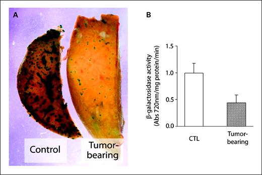 Fig. 1. The in vivo effect of EHS sarcoma on the human CYP3A4/lacZ transgene in the livers of tumor-bearing mice. A, macroscopic detection of human CYP3A4 transgene using 5-bromo-4-chloro-3-indolyl-β-d-galactopyranoside staining in a representative liver wedge from a control (left) and tumor-bearing (right) transgenic mouse. Magnification, ×10. Liver wedges were fixed with glutaraldehyde overnight at 4°C, washed in a PBS solution for 1 h, and then stained in the presence of 5-bromo-4-chloro-3-indolyl-β-d-galactopyranoside at 37°C for 30 min. Hepatocytes exhibiting the human CYP3A4 transgene expression are visualized by dark blue staining on the cut surface of the liver. B, quantification of the human CYP3A4/lacZ transgene expression in the liver of tumor-bearing transgenic and control mice. CYP3A4/lacZ expression was quantified via indirect measurement of β-galactosidase activity using the O-nitrophenyl-β-d-galactopyranoside assay. Columns, average fold inhibition for six mice; bars, SE.