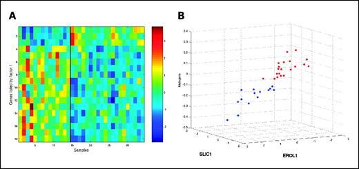 Fig. 2. Gene expression profiles that identify a hypoxia phenotype. A, image intensity display of genes identified by top models predicting the hypoxic phenotype. B, scatter plot depicting the classification of samples based on the expression patterns. The 34 samples were plotted according to the expression level of the two most highly weighted genes (SLIC1 and EROL1) in regression models predicting hypoxia. The metagene, represented on the vertical axis, represents the key predictive metagene underlying the set of 18 genes appearing in a thresholded selection of the top-scoring 100 regression models. Hypoxic cases (red), nonhypoxic case (blue).