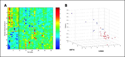 Fig. 3. Gene expression profiles reflecting clinical response to neoadjuvant chemotherapy. A, image intensity display of genes identified by top models predicting clinical response. B, scatter plot depicting the classification of samples based on the expression patterns. The 36 samples were plotted according to the expression level of the two most highly weighted genes (ASF1A and LAMA4) in regression models predicting clinical response. The metagene, represented on the vertical axis, represents the key predictive metagene underlying the set of 38 genes appearing in a thresholded selection of the top-scoring 100 regression models. Positive response, red symbols; negative response, blue symbols.