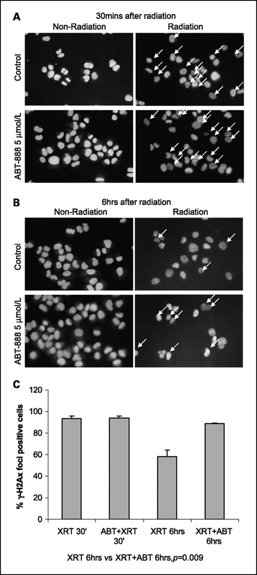 Fig. 2. PARP-1 inhibition inhibits DNA repair in H460 lung cancer cells. H460 cells were incubated with ABT-888 5 μmol/L and then immediately irradiated with either 0 or 5 Gy. Either 30 min (A) or 6 h (B) after irradiation, the slides were fixed and incubated with antibody for histone γ-H2AX, followed by a secondary antibody labeled with rhodamine red. Arrows, positive staining cells. Slides were examined on a fluorescent microscope and color print pictures were taken, and (C) the percentage of γ-H2AX foci containing cells was quantified (P = 0.009).