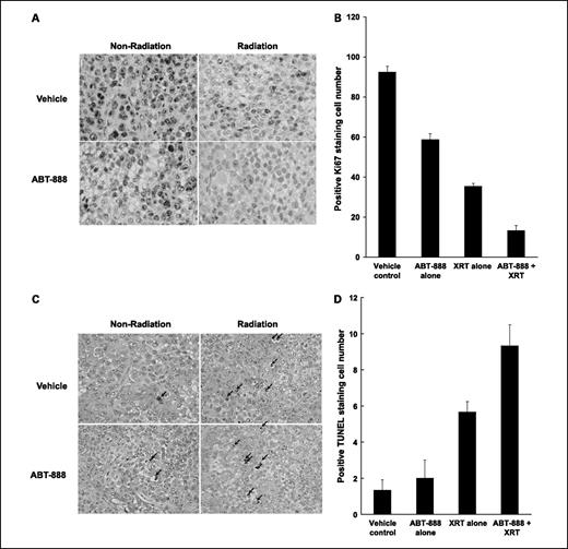 Fig. 5. ABT-888 with radiation reduces Ki67 proliferative marker and increases apoptotic index in H460 tumor models. Histologic sections were obtained from the tumors of the mice in each treatment group. A, standard Ki67 staining was done and representative images are shown. B, average proliferative index of each treatment group was determined by counting positive cells per microscopic field. This was repeated thrice. Columns, mean; bars, SD (P = 0.005 for ABT-888/radiation versus radiation alone). C, TUNEL staining was also done on tumor sections and representative images are shown. Arrows, TUNEL-positive cells. D, apoptotic index was similarly calculated by counting positive cells per microscopic field. Column, mean; bars, SD (P = 0.02 for ABT-888/radiation versus radiation alone).