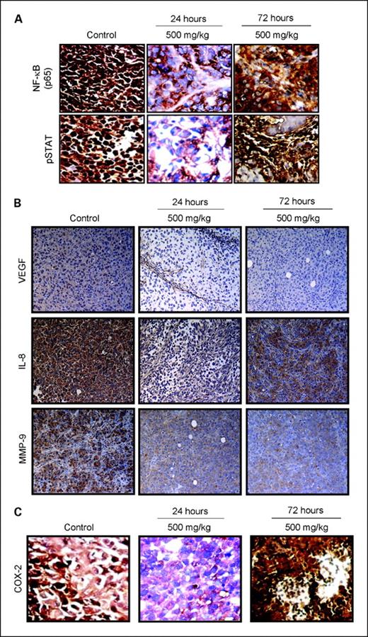 Fig. 2. A, effect of curcumin on transcription factors NF-κB and activated STAT3 as examined by immunohistochemistry. Magnification, ×200. Maximal down-regulation of these transcription factors is seen by 24 h after exposure to curcumin (500 mg/kg). Expression of NF-κB and STAT3 is back to baseline by 72 h after exposure. B, effect of curcumin on VEGF, IL-8, and MMP-9 as examined by immunohistochemistry. Magnification, ×100. C, effect of curcumin on COX-2 as seen on immunohistochemistry. Magnification, ×200.