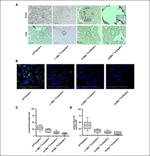 Fig. 2. [Lys40(Ahx-DTPA-111In)NH2]-Exendin-4 reduces tumor cell proliferation. A, proliferation of tumor cells was assessed by BrdUrd staining of pancreas sections 8 d after injection of the [Lys40(Ahx-DTPA-111In)NH2]-Exendin-4. The staining reveals a dramatic reduction in tumor cell proliferation (top). Arrows, proliferating tumor cells in the tumor rim (inset, higher magnification of the tumor rim). The number of BrdUrd-incorporating cells in normal islets is not affected by the treatment (bottom). Bar, 100 μm. B, immunofluorescence staining of tumor sections for cyclin D2. The ratio of cyclin D2–expressing tumor cells is reduced in a dose-dependent manner 8 d after injection of [Lys40(Ahx-DTPA-111In)NH2]-Exendin-4. Green, staining for cyclin D2; blue, 4′,6-diamidino-2-phenylindole. Bar, 50 μm. C, quantification of BrdUrd incorporation in tumor cells of treated and control mice, as indicated (percentage of total cells; P < 0.0001, one-way ANOVA). D, quantification of cyclin D2–expressing cells in tumor cells of treated and control mice, as indicated (percentage of total cells; P = 0.0042, one-way ANOVA).