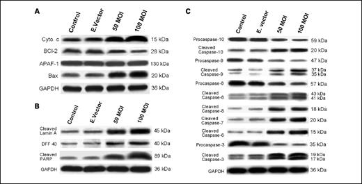 Fig. 7. A, Western blot analysis for cytochrome c (Cyto. c), Bcl-2, apoptotic protease-activating factor, and Bax in rAAV-TFPI-2–transfected U-251 cells. Cells were transfected with 50 and 100 MOI of rAAV-TFPI-2. An empty vector transfected at a concentration of 100 MOI was used as a vector control. Mitochondria were isolated from the total cell lysates, and the cytosol fraction was used to measure released cytochrome c. The nitrocellulose membranes were reprobed and analyzed for GAPDH content to show that similar amounts of protein were loaded in each lane. B, Western blot analysis for cleaved lamin A, DFF40, and cleaved PARP in rAAV-TFPI-2–transfected U-251 cells. Cells were transfected with 50 and 100 MOI of rAAV-TFPI-2. An empty vector transfected at a concentration of 100 MOI was used as a vector control. The nitrocellulose membranes were reprobed and analyzed for GAPDH content to show that similar amounts of protein were loaded in each lane. C, Western blot analysis for caspase-10, caspase-9, caspase-8, caspase-6, and caspase-3 in the cell lysates of rAAV-TFPI-2–transfected U-251 cells. Cells were transfected with 50 and 100 MOI of rAAV-TFPI-2. An empty vector transfected at a concentration of 100 MOI was used as a control. The nitrocellulose membranes were reprobed and analyzed for GAPDH content to show that similar amounts of protein were loaded in each lane.