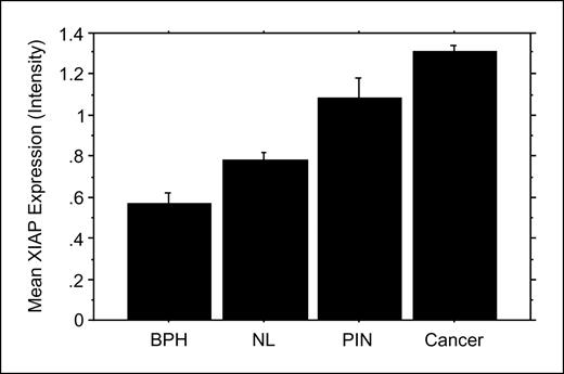 Fig. 2. XIAP protein expression distribution on the prostate tissue microarray stratified by histologic category. The intensity of XIAP protein expression in cells staining by immunohistochemistry as seen in 1,107 informative tissue microarray spots containing benign prostatic hyperplasia (BPH; n = 122), morphologically normal prostate (NL; n = 252), prostatic intraepithelial neoplasia (PIN; n = 48), and invasive prostate cancer (Cancer; n = 685) are shown as mean bar graphs. The mean XIAP expression was significantly higher in cancer (intensity = 1.32) compared with PIN (intensity = 1.08; P = 0.019), normal (intensity = 0.78; P < 0.0001), and BPH (intensity = 0.57; P < 0.0001). XIAP expression in PIN was significantly higher than normal (P = 0.010) and BPH (P < 0.0001), and expression in normal epithelium was significantly higher than that seen in BPH (P = 0.0006). The Mann-Whitney U test was used for two-group comparisons. Bars, 1 SE.