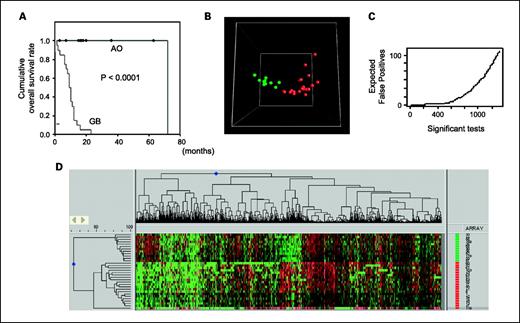 Fig. 1. A, Kaplan-Meier estimates of overall survival among 32 malignant gliomas [12 anaplastic oligodendrogliomas (AO) and 20 glioblastomas (GB)]. P value was calculated with the use of the log-rank test. B, principal component analysis of gene expression in 32 malignant gliomas. The variation in the expression levels of the 3,269 genes is reduced to a three-dimensional space. Each sphere represents each sample; green and red, anaplastic oligodendroglioma and glioblastoma, respectively. C, the expected number of false-positive genes versus the total number of significant genes given by the q values. D, unsupervised hierarchical clustering of 32 malignant gliomas using 3,269 genes. Genes (horizontal axis) and samples (vertical axis) were grouped by individual gene expression patterns. Green and red bars, anaplastic oligodendroglioma and glioblastoma, respectively.