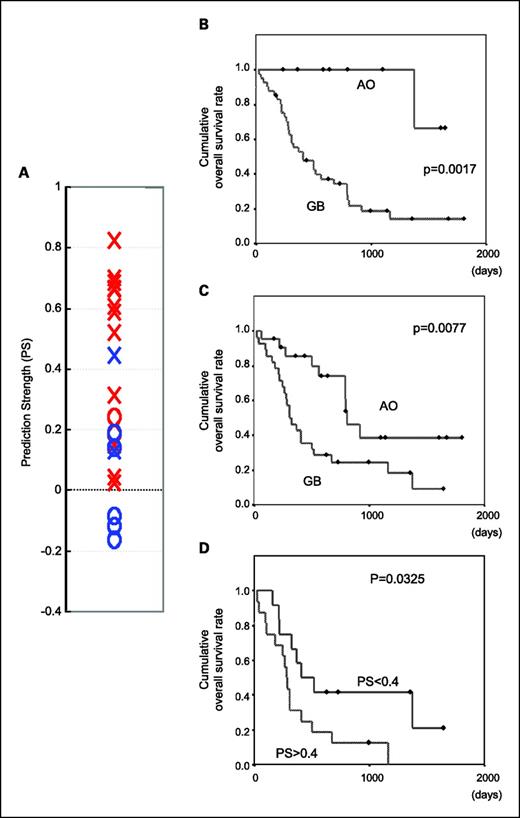 Fig. 2. Our molecular diagnosis system was applied to a MGH data set. A, the scatter plots show the PS values for the 21 classic malignant gliomas for which multiple neuropathologists were unanimous regarding the diagnosis. Red and blue, glioblastoma and anaplastic oligodendroglioma, respectively. ×, cases where overall patient survival was less than 2 y. B and C, Kaplan-Meier estimates of overall survival among all 50 malignant gliomas of a MGH data set. Classification according to (B) our molecular diagnosis system (C) histological diagnosis. D, Kaplan-Meier estimates of overall survival among 26 cases of histologically diagnosed glioblastoma in a MGH data set, stratified according to the PS with a cutoff value 0.4. P value was calculated with the use of the log-rank test.