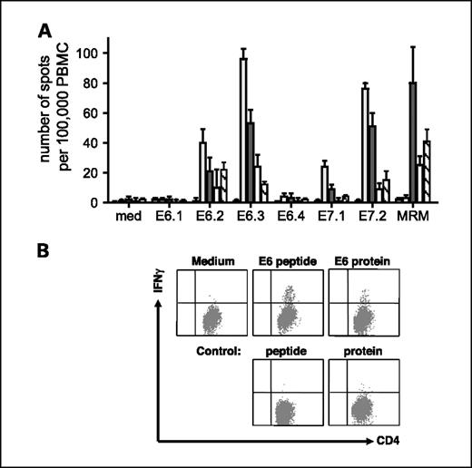 Fig. 3. Detailed analysis of HPV16-specific T-cell response of patient 14. A, IFNγ ELISPOT analysis of the HPV16-specific T-cell response after five vaccinations. The number of spots per 105 PBMCs is given before vaccination, after two vaccinations (light gray columns), after four vaccinations (dark gray columns), after five vaccinations (white columns), and 5 mo after this fifth vaccination (striped columns). Shown are the T-cell responses against the four peptide pools of HPV16 E6 and the two peptide pools of HPV16 E7. Medium only was taken along as negative control and the MRM as a positive control. B, vaccine-induced T cells recognize naturally processed HPV16 E6 protein. PBMCs left over after doing the ELISPOT analysis were subjected to an intracellular cytokine staining as described by de Jong et al. (16). The cells were stained for IFNγ and CD4 and analyzed by flow cytometry. Typical flow cytometric dot plots are shown of the responses obtained in follow-up blood sample of patient 14 after she received five vaccinations. Similarly, also, HPV16 E7-specific IFNγ-producing CD4+ T cells were observed.