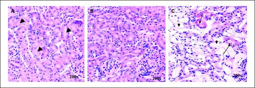 Fig. 4. Histopathologic analysis of 225Ac-DOTATOC toxicity in mice. H&E sections of nude mice at 7 months after injection of different amounts of 225Ac-DOTATOC. A, after injection of 10 kBq, normal glomeruli and tubuli are seen (original magnification, ×200; H&E, arrow). B, after injection of 20 kBq, no changes are seen in the kidney (original magnification, ×200; H&E). C, after injection of 30 kBq, acute tubular necrosis with partial atrophy, edema, and partial loss of epithelial cells are observed (original magnification, ×200; H&E). Many tubules show complete atrophy characterized by lumen dilation and complete denudation of the basement membrane (*). Some proximal tubules show edema and partial loss of epithelial cells (arrows). Note that the glomeruli are histologically normal.