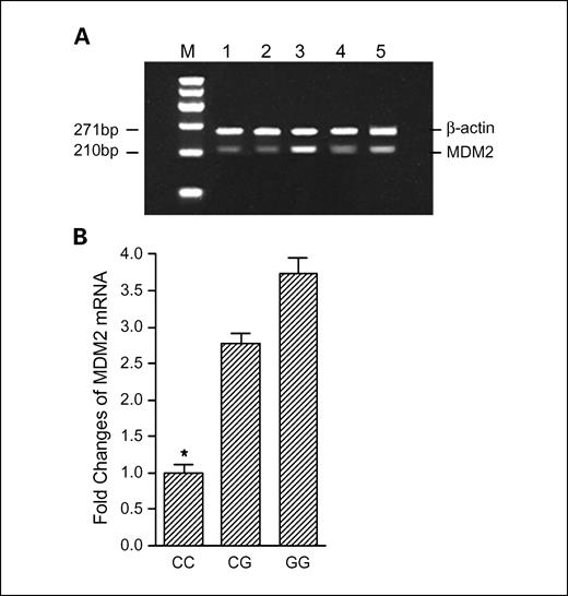 Fig. 3. Association between the C1797G polymorphism and MDM2 mRNA expression. A, representative gel picture showing RT-PCR analysis of the MDM2 mRNA in bladder tumor tissues from individuals with different MDM2 C1797G genotypes. The amplified length of PCR products was 210-bp for MDM2 and 271-bp for β-actin. Lane M, DNA size marker; lanes 1 to 5, individual samples. Individual genotype designation: lanes 1 to 2, 1797CC; lanes 4 to 5, 1797CG; and lane 3, 1797GG. B, MDM2 transcript in bladder tumor tissues detected by real-time quantitative RT-PCR. The frequency distributions of the CC, CG, and GG genotypes were 13, 6, and 3, respectively. The fold change was normalized against β-actin. *, P < 0.01 compared with the CG and CC genotypes.