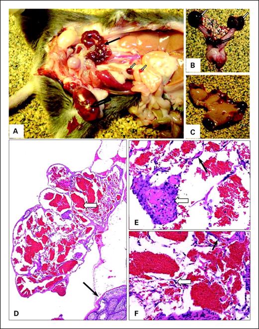 Fig. 3. Top, A to C, infection of SCL-TVA mice with PyMT virus causes hemorrhagic disease. A, abdominal area of PyMT-infected SCL-TVA mouse showing hemorrhagic seminal vesicle (black arrow) and vascular lesions in testicular area (empty arrow) and in the mesentery (white arrows). B, hemangiomatous lesions in ovaries (white arrows) and uterus (empty arrow). C, fragment of liver showing multiple hemorrhagic lesions. Bottom, D to F, representative H&E stain of vascular lesions found in testicular area of SCL-TVA mice injected with RCAS-PyMT virus. D, at low magnification (×1.4), the tumor is composed of irregular cystic cavities full of blood (white arrow). Black arrow, remnant testicular tissue. E and F, at higher magnification, the cavities are lined by flattened endothelial cells (black arrows in E and F). Solid sheets of the endothelial cells can also be seen with amorphous fibrin-like extracellular material (white arrow in E, ×200). Stellate-type cells can also be found as part of the proliferating transformed endothelium (white arrow in F, ×200).
