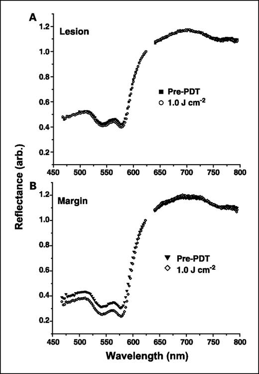 Fig. 4. Representative reflectance spectra taken from (A) a sBCC lesion and (B) adjacent margin taken before and after 1.0 J/cm2 PDT delivered at 50 mW/cm2. Data between 625 and 640 nm are excluded due to bleed-through of the treatment laser into the reflectance channel.