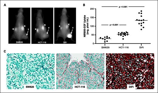 Fig. 3. Quantitative in vivo imaging of NIR800-EGF uptake reflects the relative EGFR immunoreactivity in colorectal cancer xenografts. A, representative in vivo fluorescence images of SW620 (EGFR-negative), HCT-116 (EGFR-moderate), and DiFi (EGFR-high) tumor-bearing mice 24 h post-administration of NIR800-EGF. T, tumor; K, kidney. B, relative in vivo uptake of NIR800-EGF in SW620, HCT-116, and DiFi tumors. C, total EGFR immunoreactivity in tumor specimens from SW620, HCT-116, and DiFi xenografts shown in A and B.