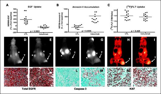Fig. 5. Noninvasive imaging assessment of response to EGFR blockade with cetuximab in DiFi xenograft-bearing mice. Treated and untreated cohorts bearing DiFi xenograft tumors were simultaneously imaged with NIR800-EGF, NIR700-Annexin V, and [18F]FLT PET. Following cetuximab treatment, DiFi tumors exhibited significantly reduced NIR800-EGF uptake (A) and increased NIR700-Annexin V uptake (B) compared with untreated controls. No statistical difference in [18F]FLT uptake was observed between treated and untreated mice. Units are defined as tumor (T)/muscle (M) Ratio (C). Representative NIR800-EGF, NIR700-Annexin V, and [18F]FLT PET images collected from an individual control (D, F, and H) and treated (E, G, and I) mouse. Strong agreement between the imaging metrics of response and standard immunohistochemistry was observed. Tumors from control (J) and treated (K) animals exhibited similar levels of total EGFR. Treated animals (M) exhibited elevated caspase-3 staining compared with untreated cohorts (L). No discernible difference in Ki-67 staining was observed between tumors from control (N) and treated cohorts (O).