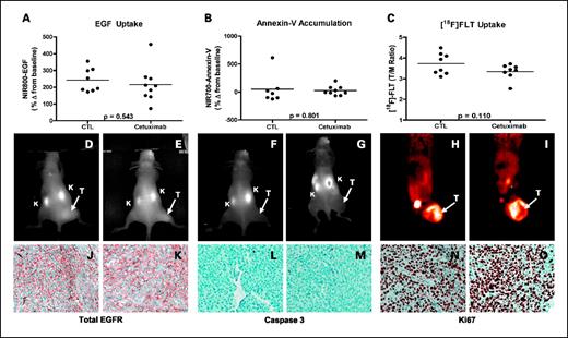 Fig. 6. Noninvasive imaging assessment of response to EGFR blockade with cetuximab in HCT-116 xenograft-bearing mice. Treated and untreated cohorts bearing HCT-116 xenograft tumors were simultaneously imaged with NIR800-EGF, NIR700-Annexin V, and [18F]FLT PET. Following cetuximab treatment, NIR800-EGF uptake in HCT-116 tumors appeared modestly reduced, although the difference was not significant (A). NIR700-Annexin V uptake (B) was similar in both treated and untreated mice. C, cetuximab-treated HCT-116 mice displayed modestly reduced [18F]FLT uptake compared with untreated controls that approached statistical significance. Representative NIR800-EGF, NIR700-Annexin V, and [18F]FLT PET images were collected from an individual control (D, F, and H) and treated (E, G, and I) mouse. Strong agreement between the imaging metrics of response and standard immunohistochemistry was observed. Tumors from control (J) and treated (K) animals exhibited similar levels of total EGFR. Caspase-3 staining was similar in both control (L) and treated (M) tumors. No discernible difference in Ki-67 staining was observed between tumors from control (N) and treated (O) cohorts.