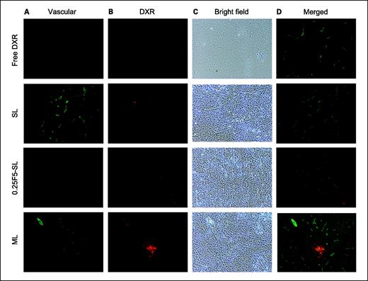 Fig. 4. Distribution of liposomal doxorubicin in M109 solid tumors measured by fluorescence microscopy. M109 cells were inoculated subcutaneously into female CDF1 mice. Twenty-four hours after intravenous administration of liposomes at a dose of 5 mg/kg doxorubicin, the tumor was excised and processed by frozen sectioning at 10 μm. Immunofluorescent staining of tumors by CD31 antibody is shown. Magnification, ×100. Green signals, location of neovessels; red signals, location of doxorubicin.