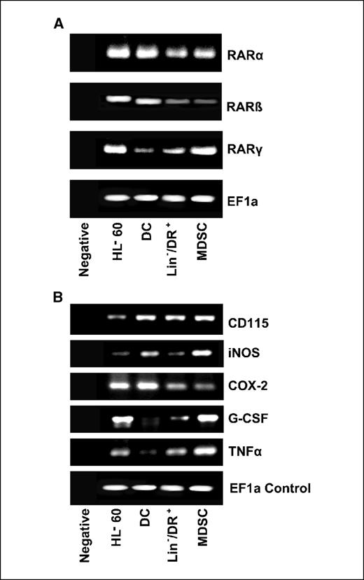 Fig. 5. Reverse transcription-PCR analysis of renal cell carcinoma-derived MDSC. Total RNA from dendritic cells (DC), HL-60 cell line, MDSC, and lineage-negative/DR+ renal cell carcinoma-derived cells (Lin−/DR+) were isolated using Trizol reagent (Invitrogen). Reverse transcription was done at 25°C for 10 min, 42°C for 2 h, and 72°C for 5 min from 100 ng of total RNA using Superscript II reverse transcriptase (Invitrogen) and random primers (3 μg/μL; Invitrogen). A, expression of receptors for ATRA; B, expression of MDSC related genes.