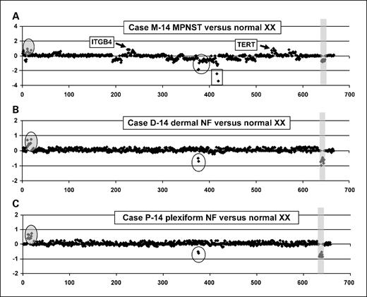 Fig. 3. Comparison of hybridization profiles of MPNST, dermal, and plexiform neurofibroma samples from the male patient 14. The germline mutation in this patient was the hemizygous deletion of the NF1 exons 2 and 3. Shaded oval, amplification of the CCND1 gene (ID 10-19). A, array CGH profile of MPNST sample M-14. Oval, homozygous deletion of the NF1 exons 2 and 3 (ID 376 and 377; −1.85 ± 0.01) and the hemizygous loss of the remaining NF1 gene (ID 378-398; −0.64 ± 0.06). Rectangle, biallelic loss of the p16INK4A/CDKN2A gene (−1.80 ± 0.16). B, hybridization of the dermal neurofibroma sample D-14 and (C) the plexiform sample P-14 to the MPNST array identified the germline mutation and the amplification of the CCND1 gene.
