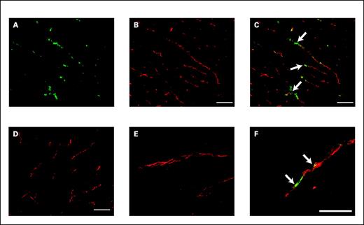 Fig. 6. Localization of bavituximab to tumor vessels after injection into rats bearing syngeneic Dunning R3227-AT1 prostate tumors. Rats were injected i.v. with bavituximab or rituximab. After 24 h, the rats were exsanguinated and their tumors were removed. A-C show blood vessels in a frozen section of tumor at low magnification. A, stained with biotinylated goat anti-human IgG followed by Cy2-streptavidin (green) to detect localized bavituximab; B, stained with mouse anti-rat CD31 followed by Cy3-labeled goat anti-mouse IgG (red) to detect vascular endothelium; C, a merged image of bavituximab localized on CD31-positive endothelium (thick). D, a merged image of blood vessels in the tumor of a rat injected with rituximab. No binding of rituximab was detected. E-F, higher magnification merged images of blood vessels in tumors from rats injected with rituximab (E) or bavituximab (F). Bars, 100 μm.