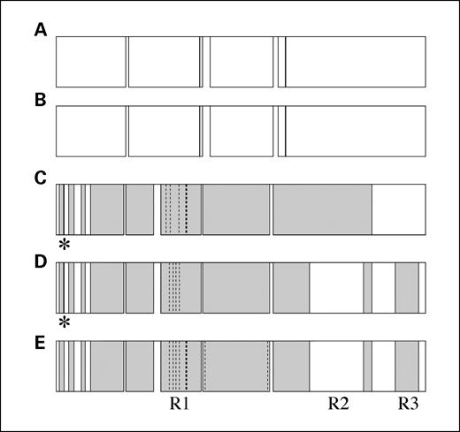 Fig. 3. Schematic representation of the vacA gene in H. pylori isolates from members of family F7. Regions of homology between vacA genes are represented by regions of white and gray. A and B, identical s1/m1 vacA alleles in H. pylori strain 14 from subjects F7-C and F7-D. C and D, nonidentical s1/m2 vacA alleles in strain 14 from subjects F7-C and F7-D, respectively. There were 80 nucleotide substitutions between the two different s1/m2 vacA alleles, 78 of which occurred within three regions (R1, R2, and R3) of 289, 544, and 270 bp (11, 36, and 31 substitutions, respectively). The asterisks represent stop codons located close to the 5′ end of the gene that terminates VacA translation. E, s1/m2 vacA allele in strain 13 from subject F7-B: there were only 7 of 3,915 bp differences to the s1/m2 vacA allele in subject F7-D above, but one of these meant there was no early stop codon and full-length VacA was translated. The dashed lines in R1 (C-E) represent single-nucleotide substitutions between alleles and the thick dashed lines represent four consecutive nucleotide substitutions. There were two additional single nucleotide substitutions in vacA from subject F7-B after R1.