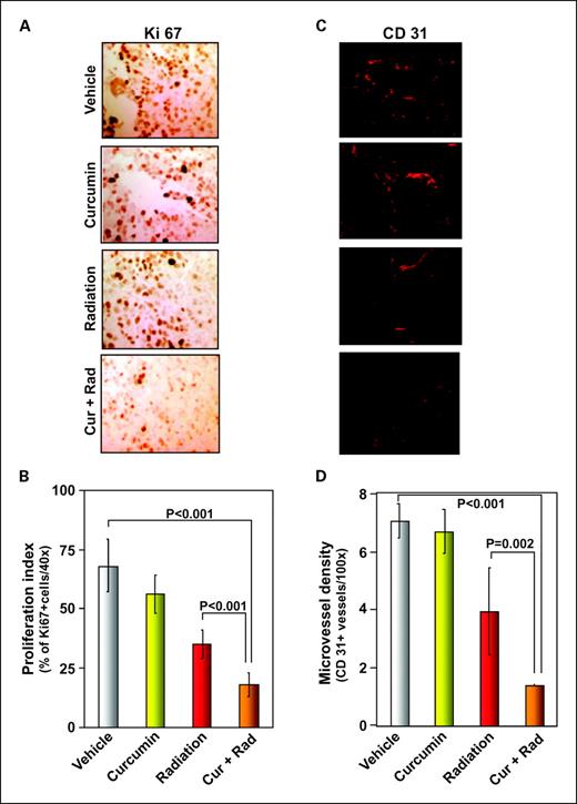 Fig. 2. Curcumin potentiates the effect of radiation against tumor cell proliferation and angiogenesis in colorectal cancer xenograft. A, immunohistochemical analysis of proliferation marker Ki-67 indicates the inhibition of colorectal tumor cell proliferation in curcumin alone or in combination with radiation-treated groups of animals. B, quantification of Ki-67+ cells as described in Materials and Methods. Columns, mean of triplicate; bars, SE. C, immunohistochemical analysis of CD31 for microvessel density in colorectal tumors indicates the inhibition of angiogenesis by curcumin alone and curcumin alone and in combination with radiation. D, quantification of CD31+ microvessel density as described in Materials and Methods. Columns, mean of triplicate; bars, SE.