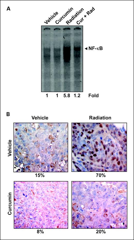 Fig. 3. Curcumin inhibited radiation induced NF-κB activity in colorectal tumors. A, detection of NF-κB by DNA binding in colorectal tumor tissue samples showed the inhibition of NF-κB by curcumin. The numbers indicated are fold activation in relation to human myeloid KBM-5 cells as one. B, immunohistochemical analysis of nuclear p65 showed the inhibition of NF-κB by curcumin alone or in combination with radiation. Percentage indicates p65 nuclear positive cells. Samples from three animals in each group were analyzed, and a representative data is shown.
