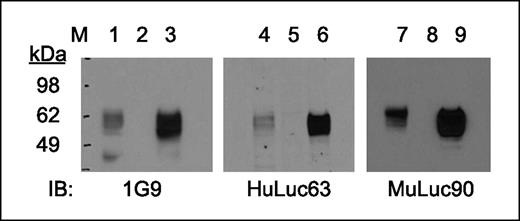 Fig. 2. Western blot analysis using anti-CS1 mAbs 1G9, HuLuc63, and MuLuc90 show specificity for CS1. Cell extracts were made from OPM2 multiple myeloma cells (lanes 1, 4, and 7), parental 293 cells (lanes 2, 5, and 8), and 293 cells transfected with a CS1 expression vector (lanes 3, 6, and 9). Immunoblots probed with anti-CS1 mAbs 1G9, HuLuc63, and MuLuc90 show a broad reactive protein band(s) of ∼60 kDa in the OPM2 and the CS-transfected 293 cells. M, markers in kDa.