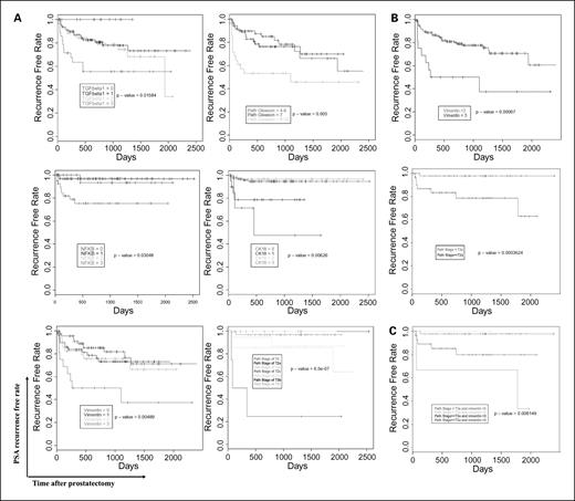 Fig. 5. NF-κB-mediated TGF-β-induced EMT predicts prostate cancer recurrence. A, Kaplan-Meier curve was generated for significant variables. TGF-β1 (P = 0.0158), vimentin (P = 0.00489), CK18 (P = 0.00626), NF-κB (P = 0.0305), pathologic stage (P = 6.5e-07), and Gleason score (P = 0.005) all have significant effect on PSA recurrence. On the other hand, clinical stage, surgical margin status, TβRI, TβRII, and p-Smad2 had no significant effect on PSA recurrence (P > 0.05). B, vimentin expression was classified into two groups (3 and <3) and pathologic stage as T0, T1, T2, and T3 with scores 0, 1, 2, and 3, respectively. There was a significant difference in the survival curves. C, Cox proportional hazards model was fit to include all the significant variables and backward selection method was used to eliminate nonsignificant variables and the final selected model includes vimentin (log-rank P = 0.049; hazard ratio, 2.03; 95% confidence interval, 1-4.12) grouped as <3 and 3 and pathologic stage grouped as <T3a and ≥T3a (log-rank P = 0.031; hazard ratio, 10.1; 95% confidence interval, 1.23-82.8). Patients with pathologic stage >T3a have a 10.1 times higher biochemical recurrence rate than patients with pathologic stage underwent T3a. Patients with tissue level vimentin of 3 had a 2.03 times higher biochemical recurrence rate than patients with lower tissue levels of vimentin.