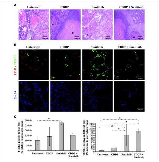 Fig. 3. Histologic characterization of CDDP and sunitinib-treated tumors. Mice bearing TGT38 choriocarcinoma were treated with vehicle, three doses of 2 mg/kg CDDP, 40 mg/kg sunitinib for 15 d, or the combination of both drugs. Mice were sacrificed when control mice tumors affected the well-being of the animals (20-25 d after tumor implantation, approximately) and sections from tumors were stained for H&E, CD31, and TUNEL. A, H&E staining showed increased necrosis (n) in CDDP and CDDP + sunitinib-treated tumors, whereas percentage of necrotic tissue in sunitinib-treated tumors was very low. Bar, 200 μm. B, CD31 and TUNEL staining of viable tumor zones showed an increase in apoptosis induced by sunitinib treatment in both tumor and endothelial cells. Bar, 80 μm. C, quantification of tumoral and endothelial TUNEL staining was done using ImageJ software. Mean ± SD of five sections of each tumor (seven tumors per treatment group), expressed as the percentage of positive staining for TUNEL relative to untreated group. *, P < 0.05.