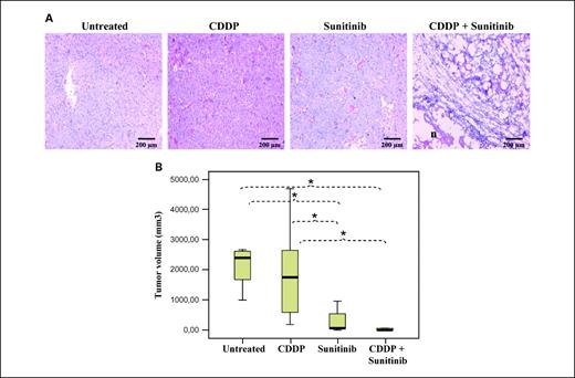 Fig. 6. Sunitinib inhibited tumor growth in a CDDP-resistant model of testicular GCT. Mice bearing the CDDP-resistant variant of TGT38 choriocarcinoma (TGT38R) were treated with vehicle, three doses of 2 mg/kg CDDP, 40 mg/kg sunitinib for 15 d, or their combination. Histologic characterization (A) and tumor volume (B) were analyzed. A, H&E staining showed increased necrosis only in CDDP + sunitinib-treated tumors, whereas percentage of necrotic tissue in CDDP or sunitinib-treated tumors was very low. Bar, 200 μm. B, combined therapy did not improve the effect on tumor volume induced by either compound. *, P < 0.05.