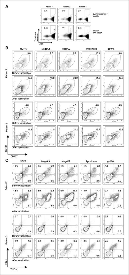 Fig. 4. Induction of CD8+ T cells specific for other antigens than MelanA in melanoma patients both in vitro and in vivo. A, TriMix DCs as prepared for vaccination were used to stimulate CD8+ T cells isolated from the blood of unvaccinated HLA-A2+ melanoma patients. Cytokine cocktail–matured DCs pulsed with HLA-A2–restricted Mage-A3–, Mage-C2–, tyrosinase-, or gp100-specific peptide were used as control. After three weekly stimulations, the cells were stained with anti-CD8 antibody and a panel of HLA-A2 tetramers loaded with different Mage-A3–, Mage-C2–, tyrosinase-, or gp100-specific peptides. TAA-specific CD8+ T cells were then identified by flow cytometry. Background staining with NY-ESO-1–specific HLA-A2 tetramers, which never reached higher than 0.1%, was subtracted. B, the activation status and cytolytic activity of CD8+ T cells from melanoma patients before or after vaccination with TriMix DCs were determined by a CD107a/137 assay. CD8+ T cells isolated from the blood of HLA-A2+ melanoma patients before or after vaccination with TriMix DCs were stimulated twice in vitro with the same DCs as used for vaccination. One week after the last stimulation, cells were restimulated overnight with mature DCs electroporated with TAA mRNA or NGFR as irrelevant control in the presence of anti-CD107-PE-Cy5 mAb and Golgi-stop. Cells were harvested, stained with anti-CD8-FITC and anti-CD137-PE, and analyzed by flow cytometry. T cells were gated on forward scatter/side scatter characteristics and CD8 positivity. The percentage of CD137/CD107a double-positive cells is given. C, cytokine production of CD8+ T cells from melanoma patients before or after vaccination with TriMix DCs was determined by intracellular cytokine staining. CD8+ T cells isolated from the blood of HLA-A2+ melanoma patients before or after vaccination with TriMix DCs were stimulated twice in vitro with the same DCs as used for vaccination. One week after the last stimulation, cells were restimulated overnight with mature DCs electroporated with TAA mRNA or NGFR as irrelevant control in the presence of Golgi-plug. Then, T cells were stained for CD8, IFN-γ, and TNF-α positivity. T cells were gated on forward scatter/side scatter characteristics and CD8 positivity. The percentage of IFN-γ– and/or TNF-α–secreting cells is given.