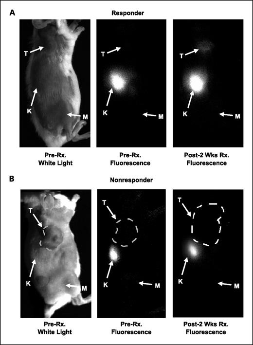 Fig. 1. Accumulation of NIR700-Annexin V is enhanced in MMTV/HER2 tumors responding to trastuzumab. NIR700-Annexin V was administered i.v., and mice were serially imaged up to 44 h before and after treatments with trastuzumab or vehicle (PBS). Representative images from responding (A) and nonresponding (B) MMTV/HER2 tumor-bearing mice (24-h images shown). Significant accumulation of NIR700-Annexin V was observed within the responsive tumor after 2 wk of trastuzumab treatment (A), whereas the nonresponsive tumor does not show significant NIR700-Annexin V uptake (B). T, tumor; K, kidney; M, reference muscle.