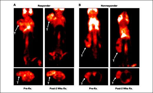 Fig. 3. MMTV/HER2 tumor uptake of [18F]FDG is similar across responding and nonresponding cohorts. Representative [18F]FDG-PET images collected before and following 2 wk of trastuzumab therapy in responding (A) and nonresponding (B) mice.