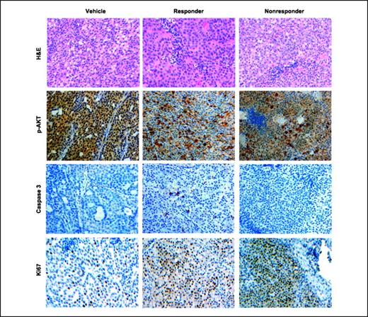 Fig. 5. In situ markers of drug action correlate with noninvasive imaging biomarkers in MMTV/HER2 tumors. Representative tumor sections from formalin-fixed, paraffin-embedded transgenic tumor transplants stained with H&E and p-AKT, cleaved caspase-3, and Ki67 antibodies as described in Materials and Methods. Compared with vehicle-treated controls, elevated cleaved caspase-3 staining was observed in MMTV/HER2 tumor tissues collected from responding, but not nonresponding, mice. Nuclear and cytoplasmic p-AKT immunoreactivity was observed in vehicle-treated control. Tumor tissues collected from responding mice showed a trend toward decreased nuclear p-AKT immunoreactivity, but staining was elevated significantly in the cytoplasm of many tumor cells. Similarly, nonresponding cohorts showed elevated cytoplasmic p-AKT, but also nuclear p-AKT, which was similar to vehicle-treated cohorts. Ki67 immunoreactivity of tumor tissues was elevated following treatment with trastuzumab compared with vehicle-treated controls.