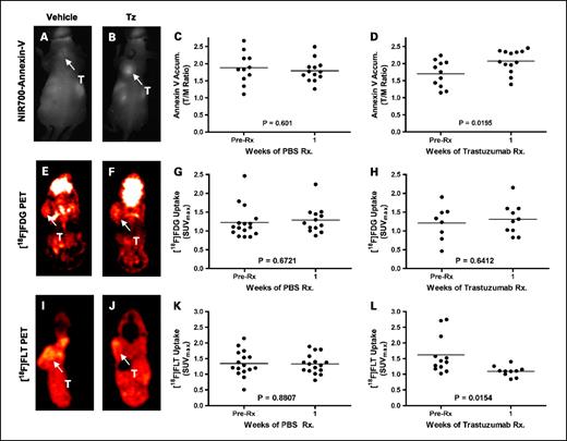 Fig. 6. Longitudinal assessment of NIR700-Annexin V accumulation, [18F]FDG uptake, and [18F]FLT uptake in vehicle- and trastuzumab-treated BT474 human breast cancer xenografts. NIR700-Annexin V accumulated significantly in trastuzumab-treated but not vehicle-treated BT474 xenografts. Representative fluorescence images of vehicle-treated (A) and trastuzumab-treated (B) BT474 tumor-bearing mice illustrating significant accumulation of NIR700-Annexin V in the tumor of a trastuzumab-treated mouse after 1 wk. Unlike the vehicle-treated cohort (C), statistically significant uptake of NIR700-Annexin V was observed across a cohort of trastuzumab-treated implicit mice (D). Similar [18F]FDG uptake was observed across vehicle- and trastuzumab-treated mice. Representative [18F]FDG-PET images and quantified [18F]FDG uptake of vehicle-treated (E/G) and trastuzumab-treated (F/H) mice are shown. [18F]FLT accumulated significantly in BT474 xenografts of vehicle-treated mice but was significantly reduced in xenografts in trastuzumab-treated mice. Representative [18F]FLT-PET images of vehicle-treated (I) and trastuzumab-treated (J) BT474 tumor-bearing mice illustrating significantly reduced [18F]FLT uptake in the tumor of a trastuzumab-treated mouse. No change in BT474 tumor [18F]FLT uptake was observed following vehicle treatment (K), yet a statistically significant decrease was observed across a cohort of trastuzumab-treated mice (L). All images and data shown were collected after 1 wk of vehicle or trastuzumab therapy.