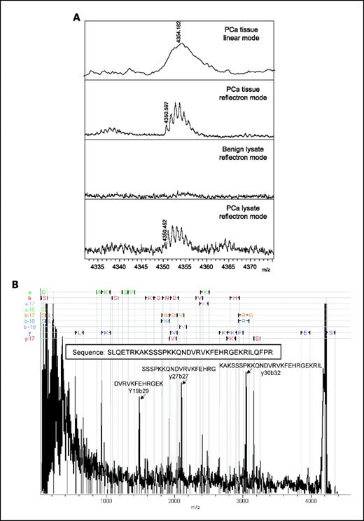 Fig. 3. Sequence identification of the peptide at m/z 4,355. A, spectra showing the peak profile of m/z 4,355 collected by direct acquisition from tissue or from tissue lysates as indicated in each panel in linear or reflectron mode. B, deconvoluted MS/MS spectra of monoisotopic peak (m/z 4,350.4) collected using TOF/TOF LIFT. Peaks attributed to internal fragments are labeled and indicated with arrows.