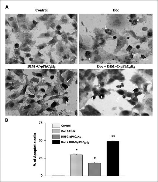 Fig. 2. Induction of DNA fragmentation in A549 cells. A, representative micrographs of A549 cells stained with TUNEL after 48 h with 0.01 μmol/L docetaxel, 7.5 μmol/L DIM-C-pPhC6H5, 0.01 μmol/L and docetaxel + 7.5 μmol/L DIM-C-pPhC6H5. DNA fragmentation is indicated by positive staining (arrows). Control cells were untreated. Micron bar, 10 μm. Arrows, apoptotic cells. Original magnification ×100. B, quantitation of apoptotic cells from TUNEL assay. Cells were quantitated by counting 100 cells from six random microscopic fields. Highest percentage of apoptotic cells was observed in the cells treated with the docetaxel + DIM-C-pPhC6H5. Columns, mean (n = 6); bars, SD. One-way ANOVA followed by post Tukey test was used for statistical analysis to compare control and treated groups. All treatments were significantly different from control (*, P < 0.001). Docetaxel treatment was significantly different from treatment with the combination (▪, P < 0.001).