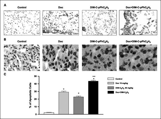 Fig. 6. Expression of cleaved caspase-3 and induction of DNA fragmentation in A549 tumors. A, immunohistochemical staining of orthotopic A549 lung tumor tissues for cleaved caspase-3 expression. Lungs were dissected from mice on day 28, fixed in 10% formalin, paraffin embedded, and sectioned. Sections were stained using the cleaved caspase-3 (Asp 175) immunohistochemistry kit as described in Materials and Methods. Cells showing caspase-3 cleavage are stained. Original magnification ×100. B, TUNEL staining of orthotopic A549 lung tumor tissues. Lungs were dissected from mice on day 28, fixed in 10% formalin, paraffin embedded, and sectioned. Sections were stained using the DeadEnd colorimetric kit as described in Materials and Methods. The apoptotic tumor cells are stained. Original magnification ×100. C, quantitation of apoptotic cells from TUNEL staining. Percentages of TUNEL-positive cells were quantitated by counting 100 cells from six random microscopic fields each in three tumor samples from different treatment groups. Columns, mean (n = 6); bars, SE. P < 0.05: *, significantly different from untreated controls; **, significantly different from DIM-C-pPC6H5 and docetaxel single treatments.