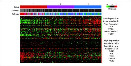 Fig. 2. Differential expression of wound response signatures in breast cancer. Expression of our in vivo wound response signature (Fig. 1) was examined in 295 tumors from the Netherlands Cancer Institute (15). Principal Component Analysis was used to divide the samples into three groups of equal size (groups I, II, and III), and the samples are ordered according to their assigned group. Gray, estrogen receptor (ER) negative; black, ER positive. For breast cancer subtype, red is basal-like; magenta, HER2 enriched; light blue, luminal B; dark blue, luminal A; green, normal-like. Two gene clusters were identified: one wherein low expression predicted poor outcome and one wherein high expression predicted poor outcome.