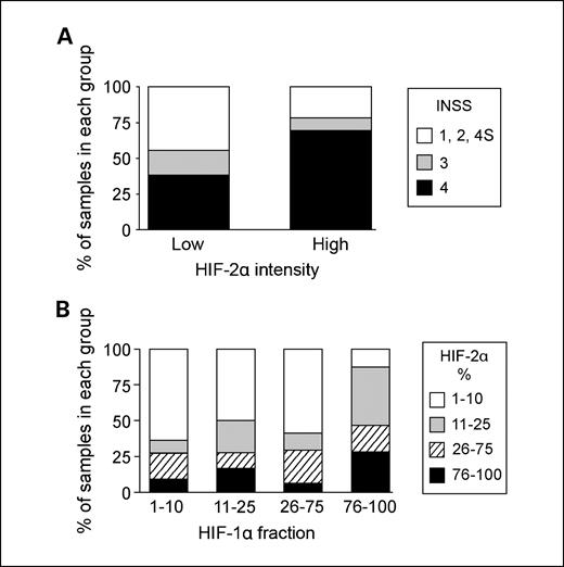 Fig. 1. A, HIF-2α protein staining intensity shows a weak significant correlation (ρ = 0.27, P = 0.02) to high clinical INSS (International Neuroblastoma Staging System) stage, as determined by three groups containing the less aggressive INSS 1, 2, and 4S tumors versus the increasingly spreading INSS stage 3 and 4 tumors. B, fraction of HIF-1α– and HIF-2α–positive cells correlates significantly with each other in neuroblastoma tumor tissue (ρ = 0.34, P = 0.002). HIF protein levels were assayed using immonhistochemical analyses on two tissue microarrays representing a total of 93 neuroblastoma cases.