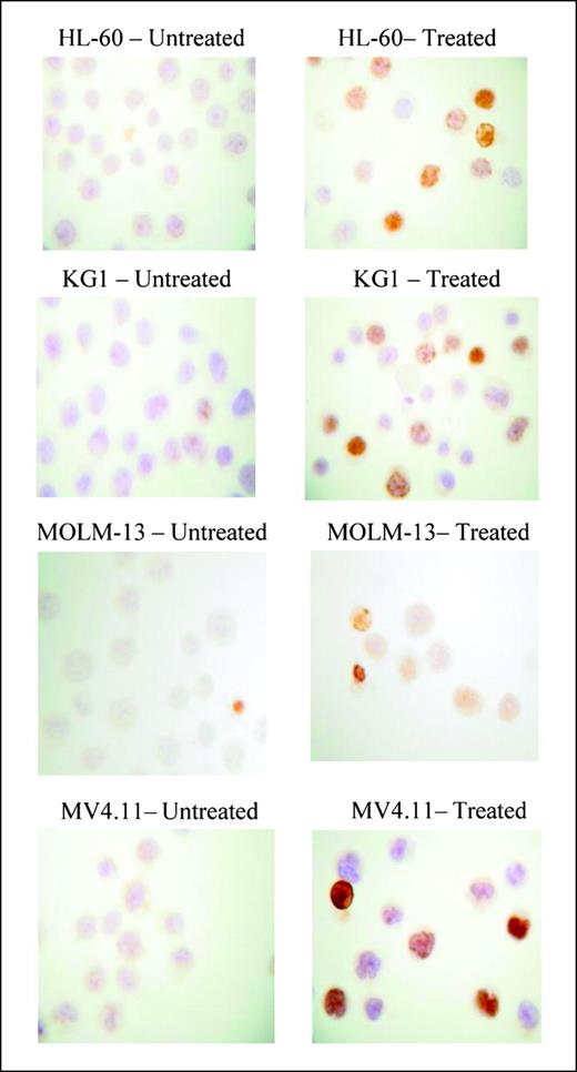 Fig. 1. γH2AX phosphorylation in leukemic cell lines. Cells were cultured for 1 h with equitoxic clofarabine (0.3 μmol/L for HL-60 and MOLM-13 and 1 μmol/L for KG1 and MV4.11). γH2AX was measured directly after treatment.