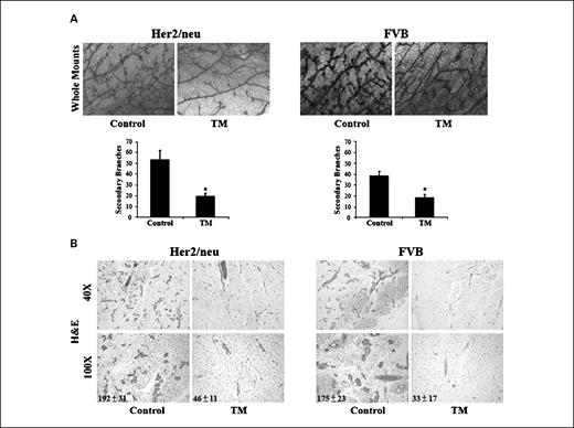 Fig. 2. Systemic TM therapy remodels mammary gland ductal morphogenesis in Her2/neu transgenic and FVB mice. A, mammary gland ductal network. Mammary glands from control and TM-treated Her2/neu and FVB mice were isolated and processed for whole-mount analysis using carmine red staining. The complexity of mammary ductal branching was quantified using carmine red–stained mammary glands to count the number of secondary branches in three representative fields (×100). Columns, mean number of secondary branches per field; bars, SEM. *, P < 0.05. B, mammary gland histology. Mammary glands from control and TM-treated Her2/neu and FVB mice were isolated, fixed, and processed for H&E staining. Mean number of mammary epithelial cells per field (×100) was calculated and presented as mean ± SEM.