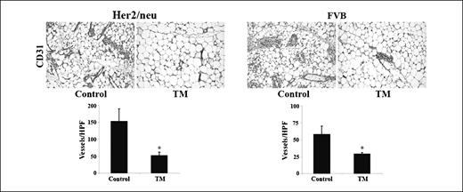 Fig. 3. Effects of systemic TM therapy on microvessel density in Her2/neu transgenic and FVB mice. Mammary glands from control and TM-treated Her2/neu and FVB were isolated, fixed, and processed for immunohistochemistry with an anti-CD31 antibody for microvessel density. Columns, mean vessel count per high-power field (×400); bars, SEM. *, P < 0.05.