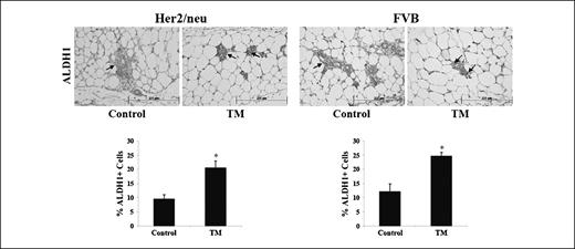 Fig. 4. Systemic TM therapy increases the number of epithelial stem cells in the mammary glands of Her2/neu transgenic and FVB mice. Mammary glands from control and TM-treated Her2/neu and FVB mice were isolated, fixed, and processed for immunohistochemistry with an anti-ALDH1 antibody (arrows, representative stained cells). Columns, mean percent of ALDH1+ mammary epithelial cells per high-power field (×400); bars, SEM. *, P < 0.05.