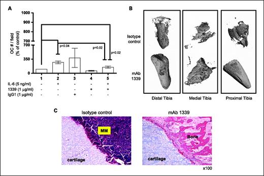 Fig. 6. Effect of 1339 on osteoclastogenesis in vitro and bone remodeling in vivo. A, to evaluate the effect of inhibition of IL-6 by 1339 on osteoclast differentiation, human preosteoclasts were stimulated with osteoclast differentiation media, in the presence and absence of IL-6, with or without 1 μg/mL of isotype control or mAb 1339, for 7 d. At the end of the treatment period, cells were fixed, stained for tartrate-resistant acid phosphatase, and counted. Data are expressed as means ± SD and are presented as percentage change from control. B and C, to evaluate the effects of 1339 on the bone compartment, SCID-hu mice were injected with INA-6 cells into the implanted bone and were treated with isotype control or mAb 1339 after the first detection of tumor. One month after treatment, bone chips were retrieved and analyzed by micro-computed tomography and histologic examination. B, a qualitative assessment of images obtained from micro-computed tomography suggests resistance to osteolytic bone destruction by mAb 1339. C, hematoxylin and eosin staining showed increased bone tissue and decreased multiple myeloma cell number in the treated samples compared with controls. Original magnification, ×100.