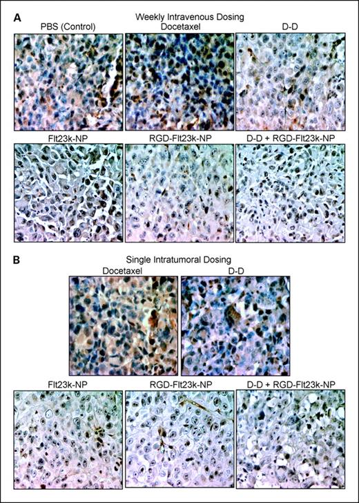 Fig. 6. In vivo assessment of efficacy of various treatment groups in inhibiting VEGF expression in H1299 lung cancer xenograft models. Representative photomicrographs of VEGF expression (brown stain) using a VEGF immunohistochemistry assay in (A) i.v. and (B) i.t. groups following various treatments including docetaxel, D-D, Flt23k-NP, RGD-Flt23k-NP, and D-D + RGD-Flt23k-NP. These are representative of sections in one of six xenografts.