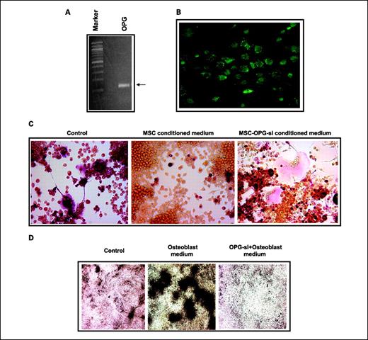 Fig. 1. Expression of osteoprotegerin by mesenchymal stem cells and its effects on osteoclast formation in vitro. A, reverse transcriptase-PCR analysis showing osteoprotegerin mRNA expression in unmodified mouse mesenchymal stem cells. B, immunocytochemical localization of osteoprotegerin in cultured mouse mesenchymal stem cells. C, preosteoclast RAW cells were cultured in mesenchymal stem cells conditioned medium in the presence of RANKL for 7 d. Tartrate-resistant acid phosphatase staining indicated inhibition of osteoclastogenesis in RAW cells grown in mesenchymal stem cells conditioned medium compared with RAW cells grown in regular medium in the presence of RANKL. Conditioned medium from osteoprotegerin-silenced mesenchymal stem cells (osteoprotegerin–knockout (KO)–mesenchymal stem cells) failed to prevent osteoclast formation. TRAP, tartrate-resistant acid phosphatase; RM, regular media; CM, conditioned media. D, control mesenchymal stem cells and osteoprotegerin–KO–mesenchymal stem cells were tested for differentiation into osteoblast lineage using osteoblast medium for 2 wk. Von Kossa staining was done to detect calcium deposits (black) to confirm that osteoblast lineage differentiation is compromised in osteoprotegerin–KO–mesenchymal stem cells (right) as compared with unmodified mesenchymal stem cells (middle). There was no positive staining in mesenchymal stem cells culture without the osteoblast medium (left).