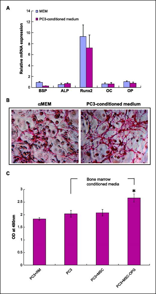 Fig. 5. Expression of osteogenic genes. A, mesenchymal stem cells were cultured for 10 d in either regular medium or PC3-conditioned medium. Total RNA was isolated, converted to cDNA, and analyzed for upregulation of osteogenic genes. Data showing no significant change in osteoblastic lineage differentiation after mesenchymal stem cells were cultured in conditioned media obtained from PC3 cells. BSP, bone sialoprotein; ALP, alkaline phosphatase; Runx2, runt-related transcription factor; OC, osteocalcin; OP, osteopontin. B, mesenchymal stem cells cultured in regular medium or PC3-conditioned medium showing equivalent alkaline phosphatase activity, indicating that PC3 cells did not initiate osteoblastic differentiation in the mesenchymal stem cells directly. C, PC3–mesenchymal stem cells in vitro coculture assay. PC3 cells were grown on hu-biogel matrix as three-dimensional spheroids and cultured in a 0.8-μm pore size transwell plate, along with mesenchymal stem cells in the lower chamber. After 72 h, the PC3 beads were collected and analyzed by MTT assay for cell proliferation. Data presented here are mean ± SE (n = 12 for each experimental conditions).